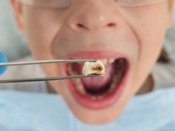Urgent Tooth Repair in MI